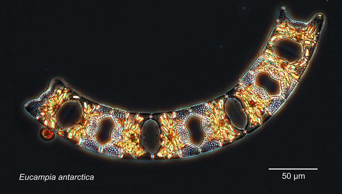 Southern Ocean plankton from the SOCLIM cruise